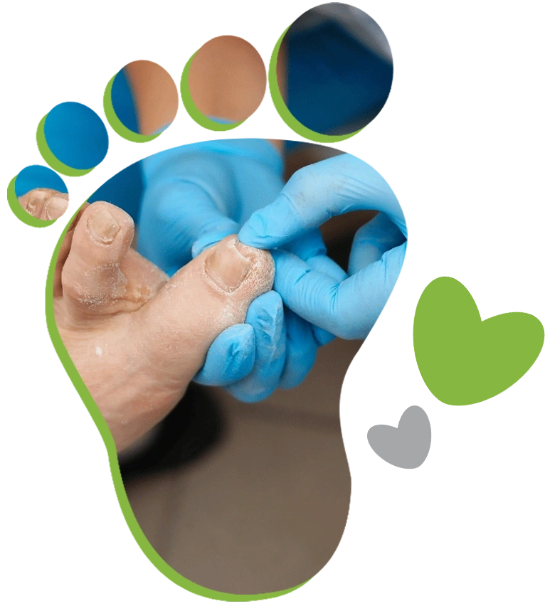 Foot Care Services in Ottawa